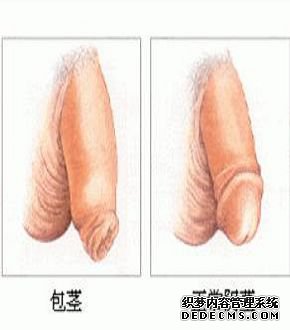 包茎的危害男性切不可小觑